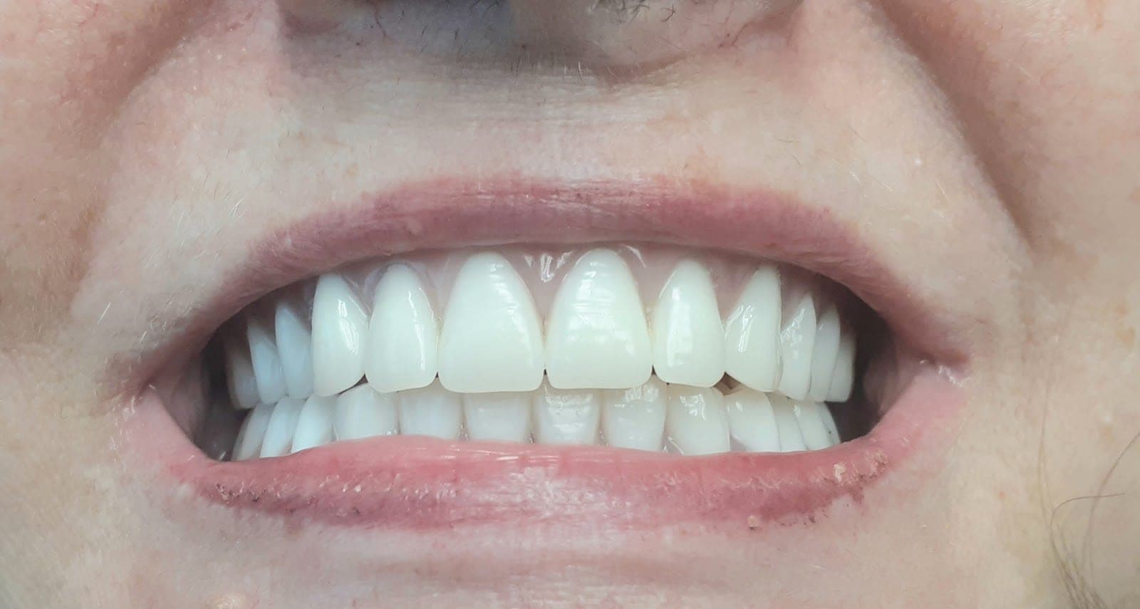 Cohen Cosmetic & Emergency Denture Clinic, EST.1982. CDCP Denture Service Plan Accepted. Expertise In Flexible Dentures. (photo: Cohen Cosmetic & Emergency Denture Clinic, EST.1982. CDCP Denture Service Plan Accepted. Expertise In Flexible Dentures., via Google)