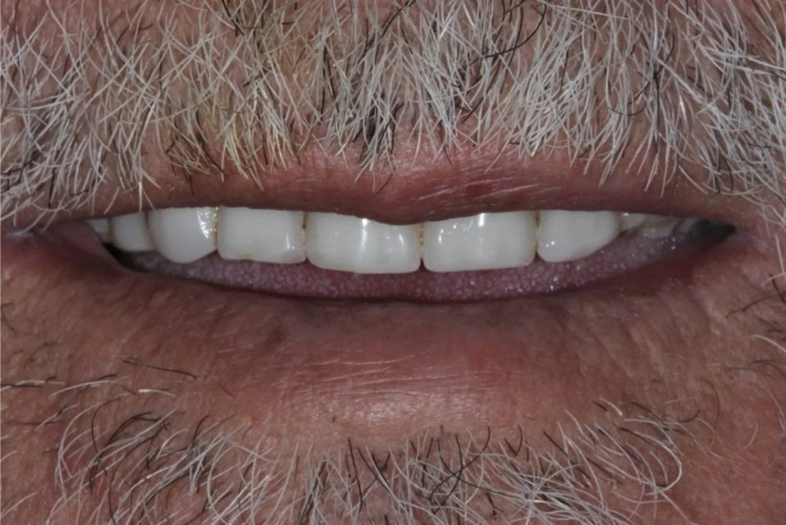 SeniorHome.ca - Richmond Denture & Implant Centre