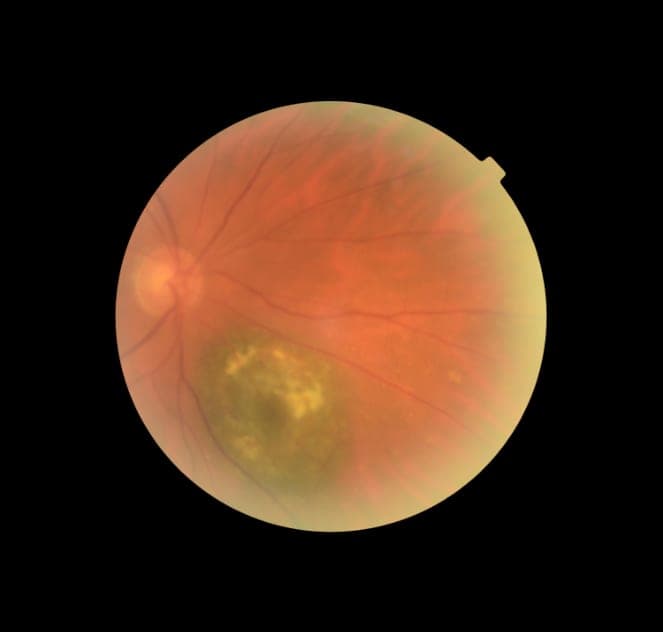 Levis Ophthalmology Clinic (photo: Clinique d'Ophtalmologie de Lévis, via Google)