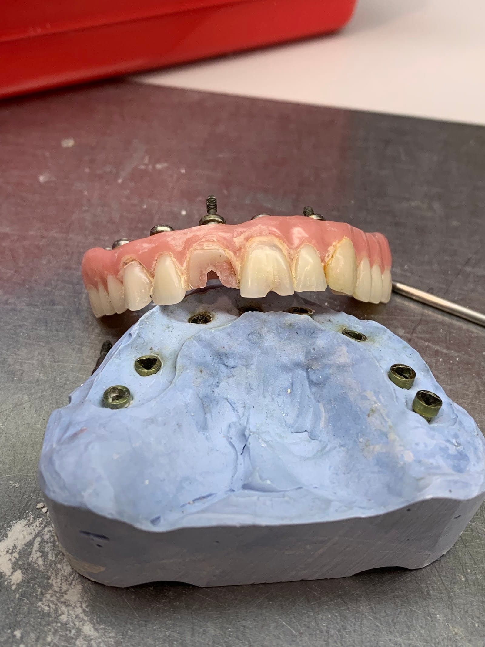 Anderson Dental Services/Prosthetics -24 Hour Denture Repairs (Brampton offices only) (photo: Anderson Dental Services/Prosthetics -24 Hour Denture Repairs (Brampton offices only), via Google)