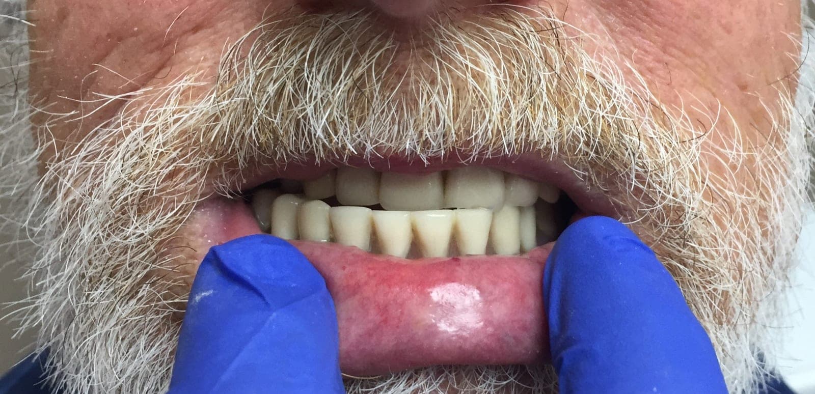 SeniorHome.ca - Okanagan Denture - Dillon Panagapko - Registered Denturist